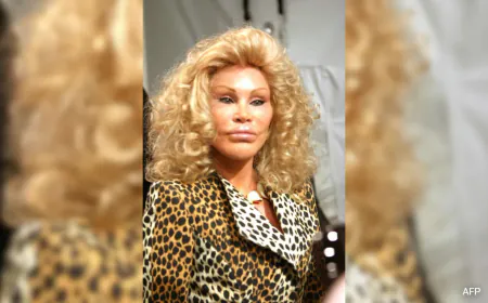 'Catwoman' Jocelyne Wildenstein, Cosmetic Surgery Aficionado, Dies At 79