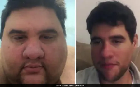 Brazil Influencer Gabriel Freitas Famed For 174-kg Weight Loss Dies At 37