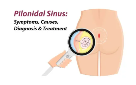 Advanced Pilonidal Treatment in Thrissur, Kerala – Dr. Raviram S.